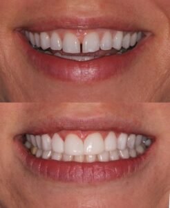 f4b827c72beeb4d89dee887f2a2a9cc5